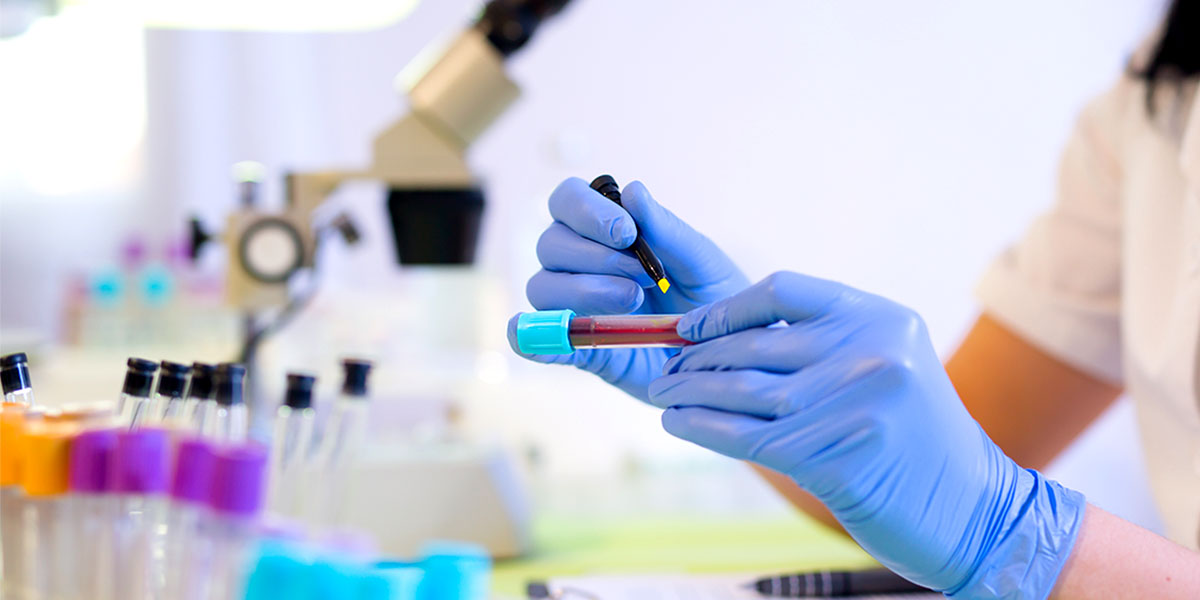 Woman working in a laboratory, writing with a felt pen.