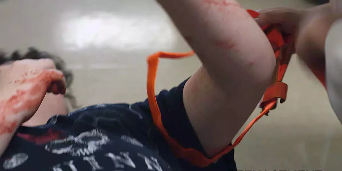 Stop the bleed reenactment of an arm trauma being treated with a tourniquet