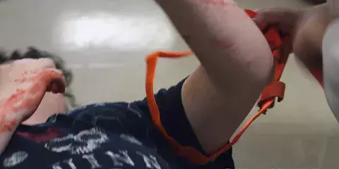 Stop the bleed reenactment of an arm trauma being treated with a tourniquet 